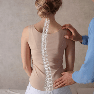 What is Scoliosis? And How is it Treated?
