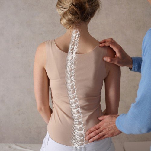 Scoliosis 101: Understanding Causes, Braces & Treatments