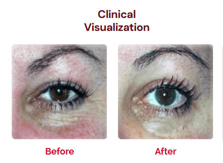 A Deep Dive Into this Effective Anti-Aging Cream