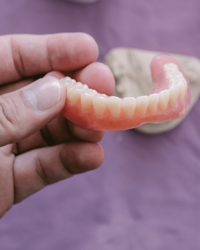 Hybrid Denture & Overdenture Care