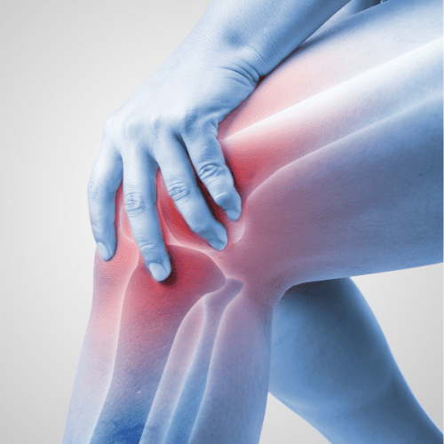 Personal Injury