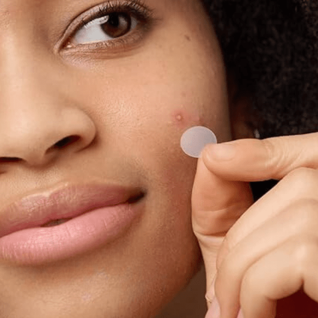 Acne Skin Care