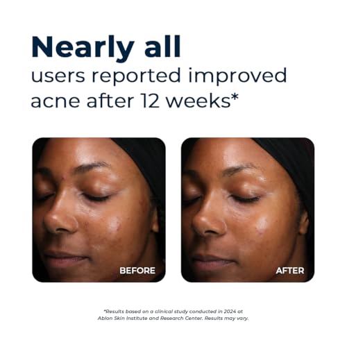 VitaMedica Clear Skin Vitamins for Acne Relief