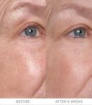 Noble Panacea Eye Lift Concentrate for Dark Circles