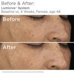 SkinMedica Lumivive Day and Night Duo