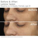 SkinMedica Lumivive Day and Night Duo