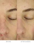 Overnight Chronobiology Peel Refill - 8 Doses