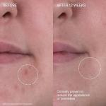 Augustinus Bader The Rich Cream - Hydrating Face Cream