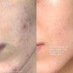 Augustinus Bader The Cream - Hydrating Face Moisturizer