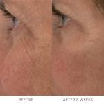 Noble Panacea Rejuvenation Night Balm Refill