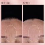 Elizabeth Arden Retinol Ceramide Renewal Capsules 30ct