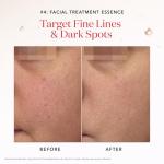 SK-II Anti-Aging Skincare Gift Set Essentials