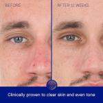 Augustinus Bader Luxury Anti-Aging Retinol Serum