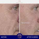 Augustinus Bader The Serum - Hydrating Anti-Aging Elixir