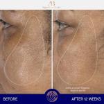 Augustinus Bader The Serum - Hydrating Anti-Aging Elixir