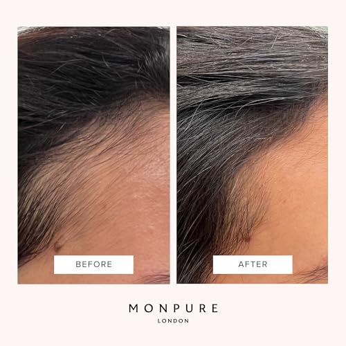 Monpure Scalp Mask: Nourishing and Stimulating Luxury Beauty