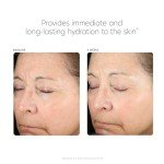 PCA Skin Hyaluronic Acid Boosting Serum 1 oz