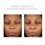 PCA Skin Hyaluronic Acid Boosting Serum 1 oz