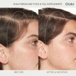 OUAI Scalp Serum for Thicker, Healthier Hair