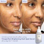Caudalie Vinoperfect Radiance Serum for Dark Spots