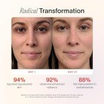 Solawave Radiant Renewal Facial Wand & Serum Bundle