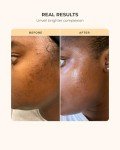 Buttah Skin Supreme Melanin Skincare Kit