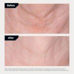 Nectifirm® Advanced Anti-Aging Neck Cream 0.5 oz