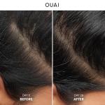 OUAI Soothing Anti-Dandruff Shampoo for Scalp Relief