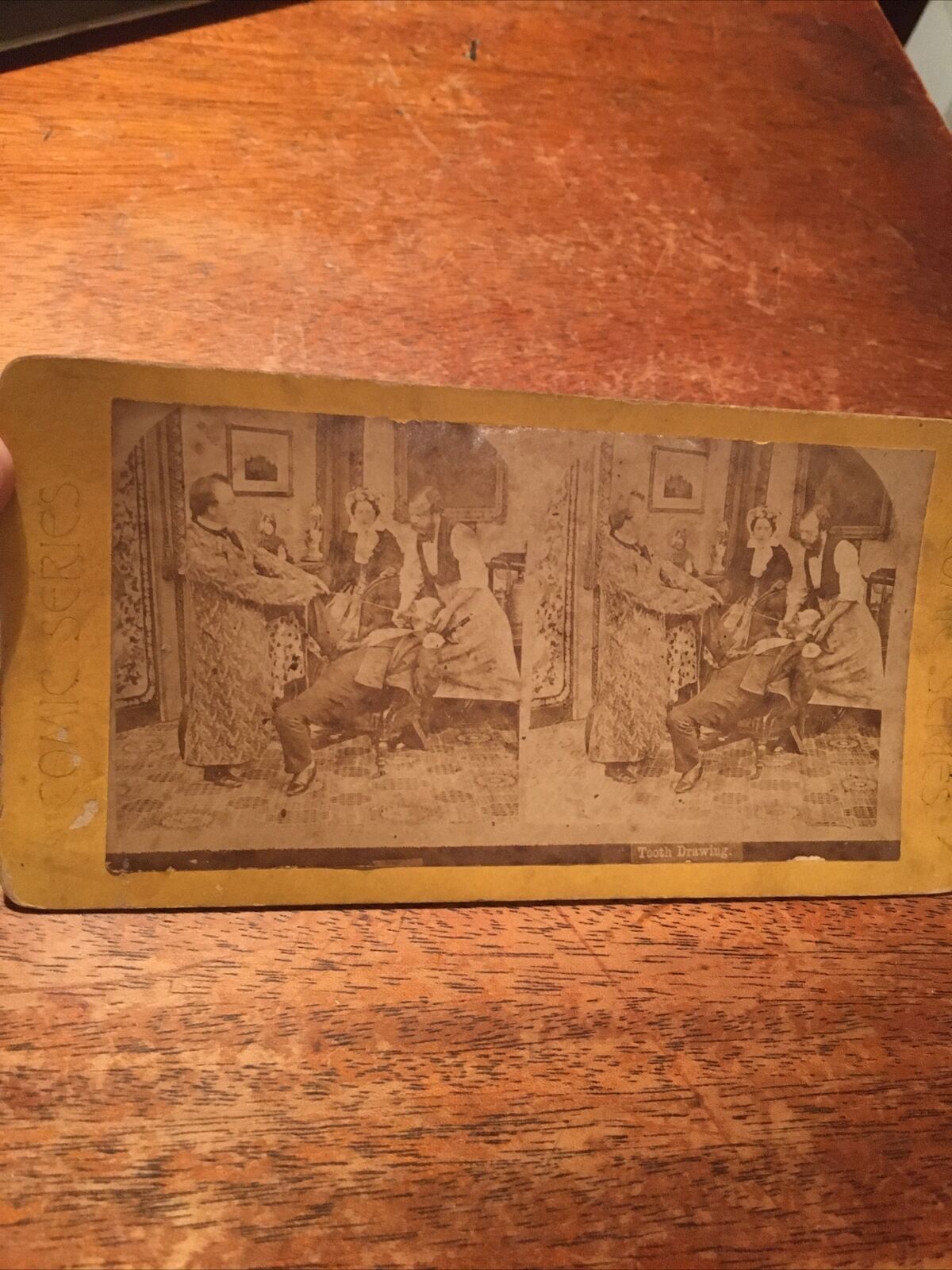 VTG. STEREO VIEW CARD Comic Series Tooth Drawing 1800s Dentistry