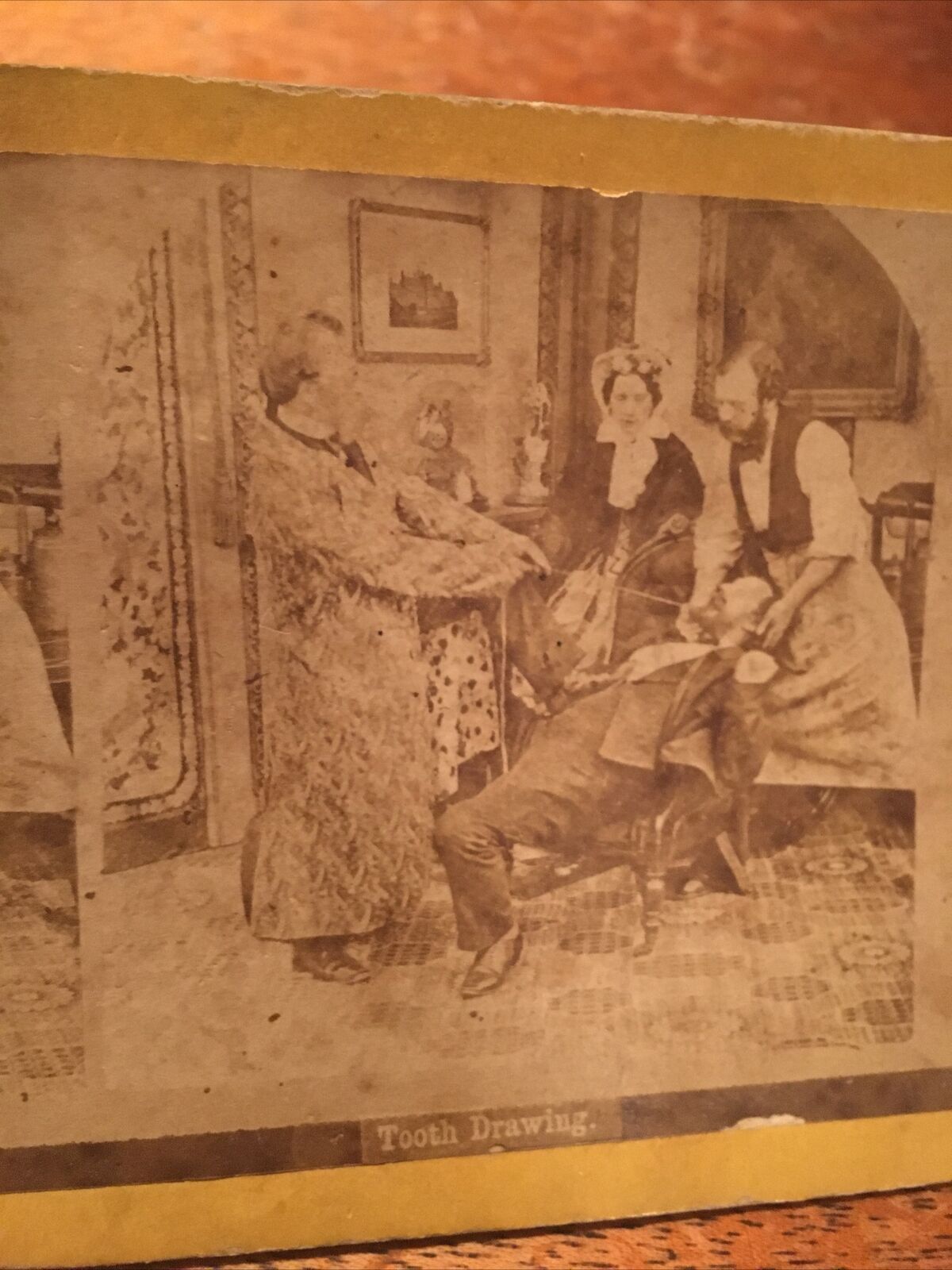 VTG. STEREO VIEW CARD Comic Series Tooth Drawing 1800s Dentistry
