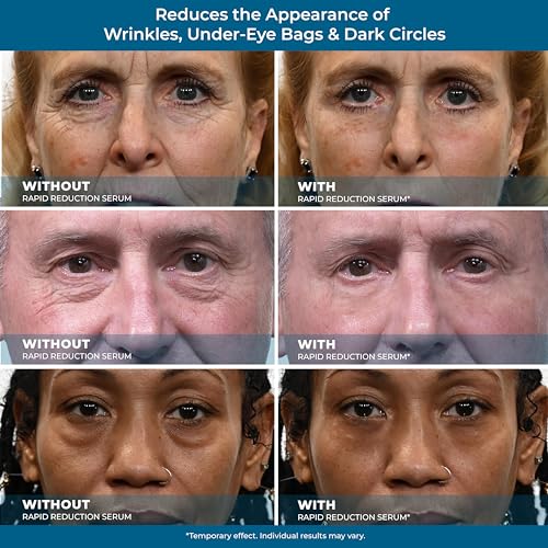 Plexaderm Rapid Reduction Eye Serum - Advanced Anti-Aging