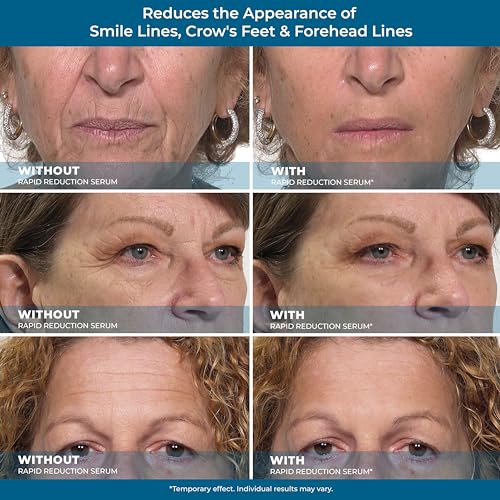 Plexaderm Rapid Reduction Eye Serum - Advanced Anti-Aging