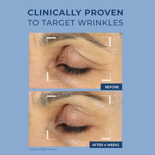 RoC Retinol Correxion Eye Cream for Dark Circles