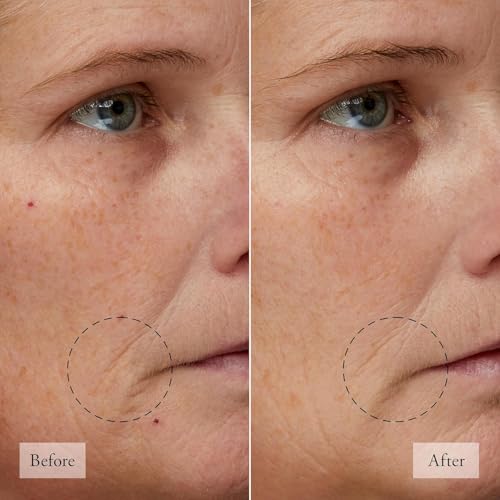 philosophy microdelivery peel for smoother, rejuvenated skin