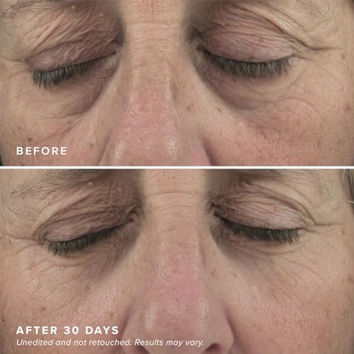 DRMTLGY Brightening Eye Masks - Caffeine Hyaluronic Acid Solution