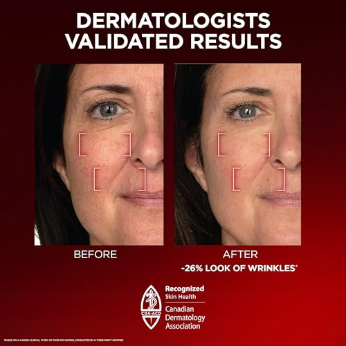 Revitalift Anti-Aging Moisturizer with Pro Retinol