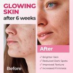 InstaSkincare Vitamin C Serum for Face & Eyes
