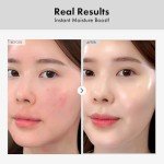 TOSOWOONG Hyaluronic Acid Hydrating Face Serum