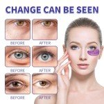 Lulesi Eye Patches for Dark Circles & Puffiness
