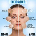 Hyaluronic Acid Facial Kit for Estheticians