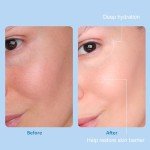 Hyaluronic Acid Facial Kit for Estheticians