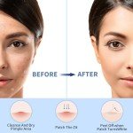 Hydrocolloid Acne Patches with Salicylic Acid, 432pcs