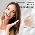 Hydrocolloid Acne Patches with Salicylic Acid, 432pcs