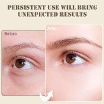 Collagen Under Eye Patches for Puffiness & Dark Circles