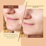 Niacinamide Serum for Clearer Skin & Pore Control