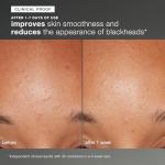 Dermalogica Daily Microfoliant Exfoliator Powder