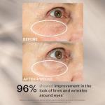 StriVectin Peptight Eye Serum for Bags and Puffiness