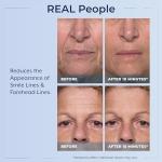 Plexaderm Eye Serum for Bags, Wrinkles, Dark Circles