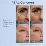 Plexaderm Eye Serum for Bags, Wrinkles, Dark Circles