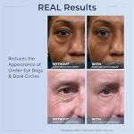 Plexaderm Eye Serum for Bags, Wrinkles, Dark Circles
